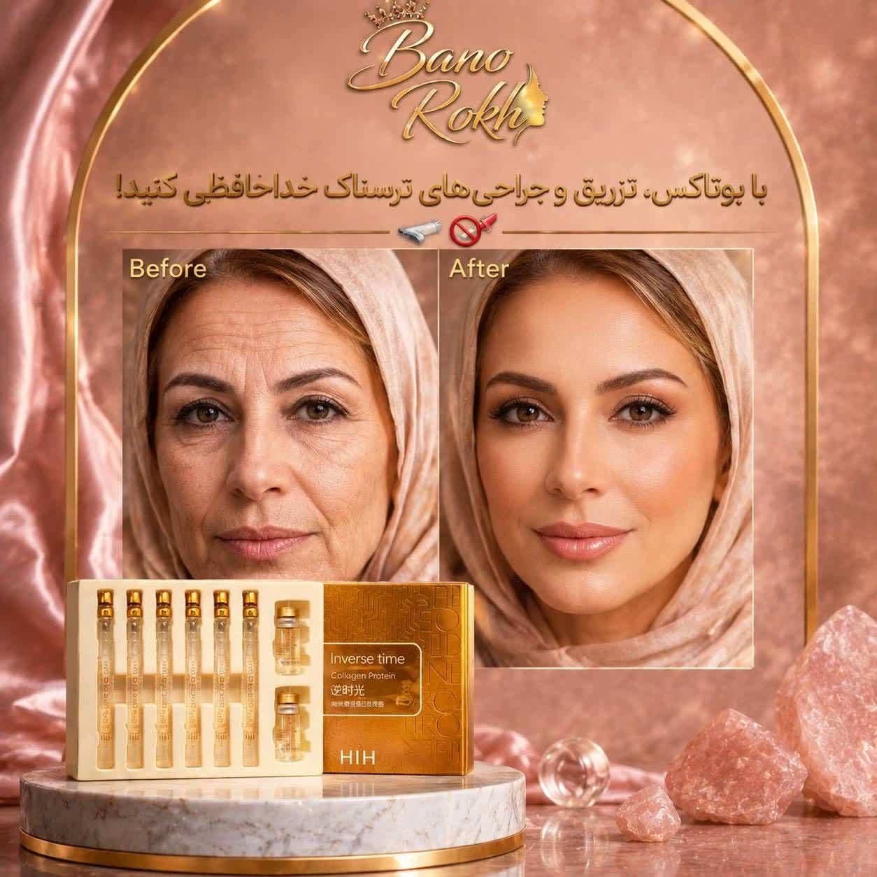 پکیج تخصصی نخ کلاژن جذبی جایگزین بوتاکس پک جوانسازی و لیفتینگ صورت با نخ کلاژن و کوکتل فیلر - نتایج قبل و بعد